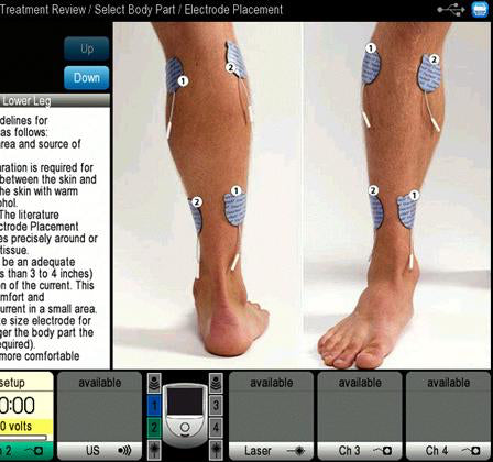 Chattanooga Intelect NEO Stim Module CH. 1&2 + EMG