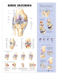 Graphique des blessures au genou