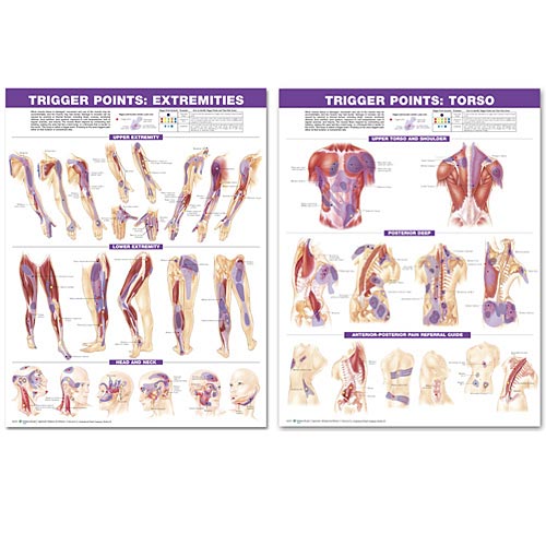 Trigger Point Chart Set: Torso and Extremities